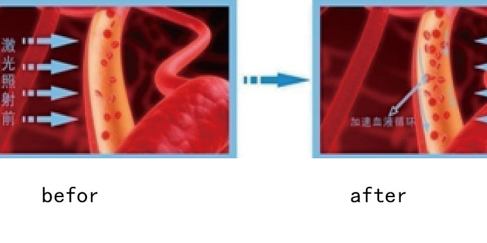 Blood condition before and after laser treatment