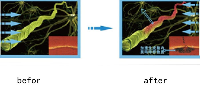 Pain reliefed after laser treatment helping the neuro system