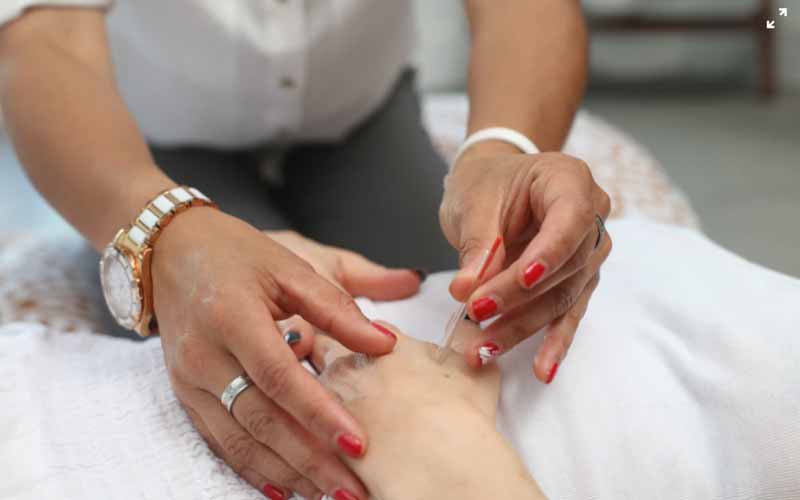 Acupuncturist inserting a needle into a patient's hand