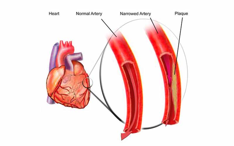 Illustration of heart and blood vessels