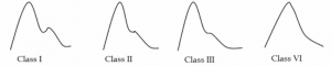 The Pulse Wave Graph